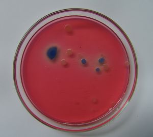 Tipos de bacteria
